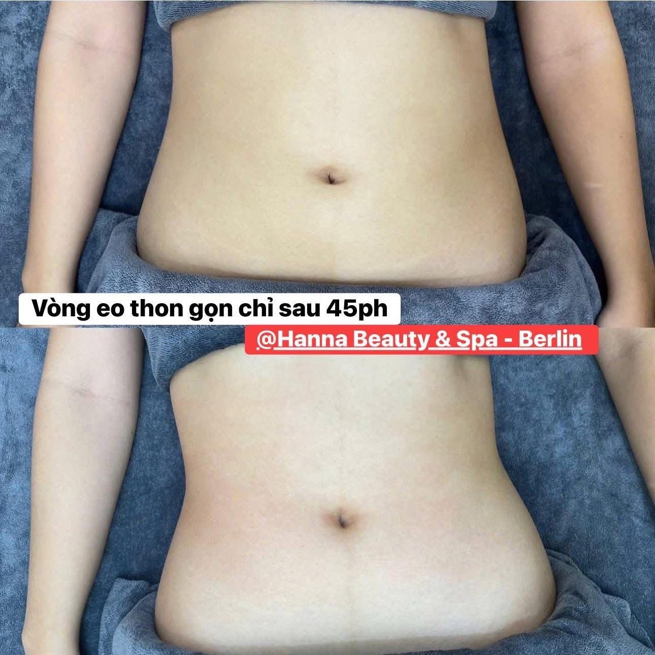 Vòng eo trước và sau 45 phút tại Hanna Beauty & Spa Berlin