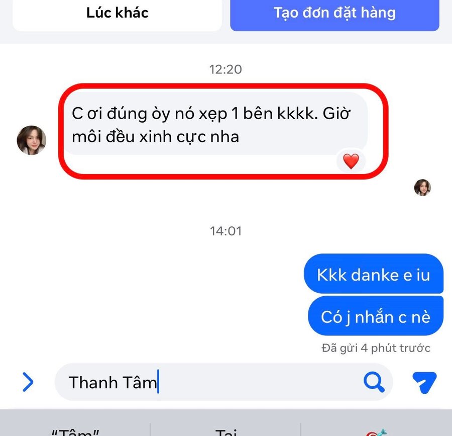 Khách nhắn môi đã xẹp đều, môi xinh cực