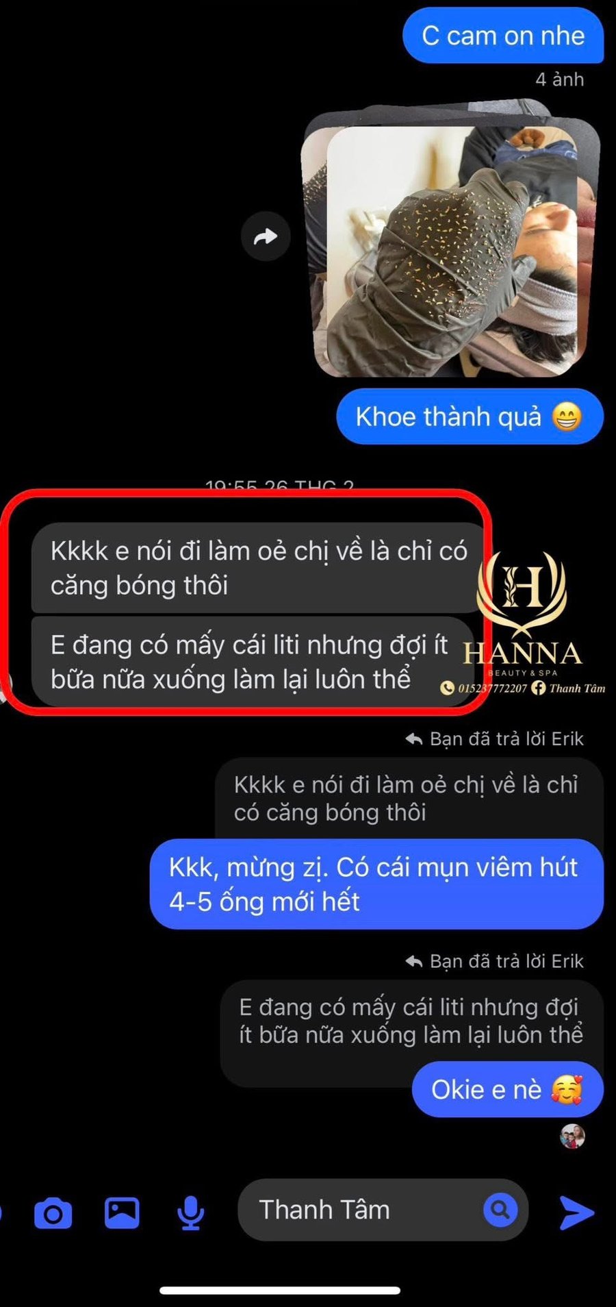 Tin nhắn khách Erik sau buổi lấy nhân mụn: đi làm ai cũng khen da căng bóng