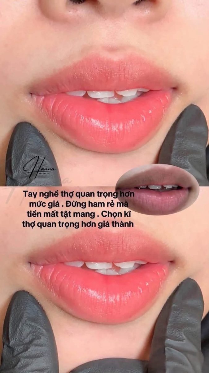 Môi sau khi phun: màu hồng cam đều, viền môi rõ